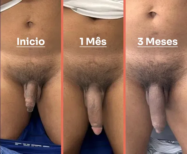 Depoimento Renato